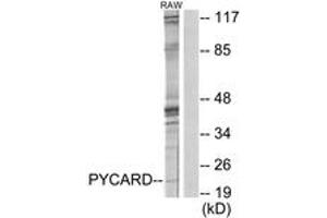 Western blot analysis of extracts from RAW264. (STS anticorps  (AA 10-59))