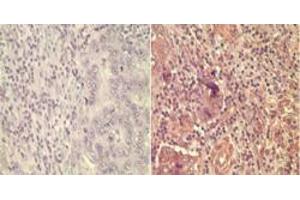 Wnt5A Immunohistochemistry.