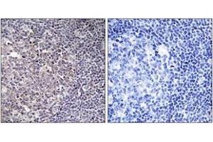 Immunohistochemistry analysis of paraffin-embedded human tonsil tissue, using BCAS4 Antibody. (BCAS4 anticorps  (AA 31-80))