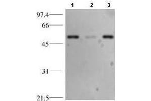 Western blotting using anti-p53. (p53 anticorps)