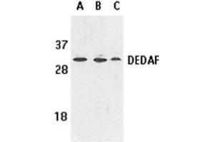 Western blot analysis of DEDAF expression in human A549 (lane A), HepG2 (lane B), and mouse 3T3 (lane C) cell lysates with AP30284PU-N DEDAF antibody at 1 μg /ml. (RYBP anticorps)