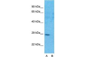 Host:  Rabbit  Target Name:  FHL1  Sample Type:  Human Fetal Heart  Lane A:  Primary Antibody  Lane B:  Primary Antibody + Blocking Peptide  Primary Antibody Concentration:  1ug/ml  Peptide Concentration:  5ug/ml  Lysate Quantity:  25ug/lane/lane  Gel Concentration:  0.