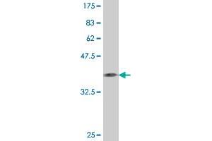 Western Blot detection against Immunogen (37. (CD93 anticorps  (AA 33-140))