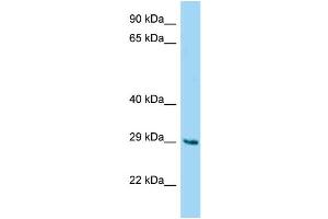 WB Suggested Anti-Fam122b Antibody Titration: 1. (FAM122B anticorps  (N-Term))