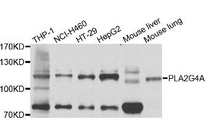 Western blot analysis of extracts of various cells, using PLA2G4A antibody. (PLA2G4A anticorps)