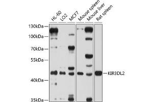 Western blot analysis of extracts of various cell lines, using KIR3DL2 antibody (ABIN6131968, ABIN6142888, ABIN6142889 and ABIN6214251) at 1:1000 dilution.
