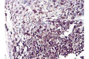Immunohistochemical analysis of paraffin-embedded tissues using breast cancer mouse mAb with DAB staining.
