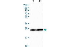 Western blot analysis of Lane 1: Human cell line RT-4 Lane 2: Human cell line U-251MG with PDAP1 polyclonal antibody  at 1:250-1:500 dilution. (PDAP1 anticorps)