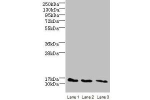 Western blot All lanes: C2orf15 antibody at 6 μg/mL Lane 1: U251 whole cell lysate Lane 2: MCF-7 whole cell lysate Lane 3: HCT116 whole cell lysate Secondary Goat polyclonal to rabbit IgG at 1/10000 dilution Predicted band size: 14 kDa Observed band size: 14 kDa (C2ORF15 anticorps  (AA 1-125))