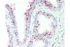 Anti-GAA antibody IHC staining of human prostate. (GAA anticorps  (AA 174-203))