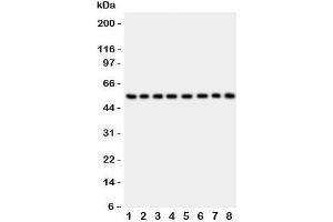 Western blot testing of P2X2 antibody and Lane 1:  rat brain;  2: mouse brain;  3: human placenta;  4: (h) HeLa;  5: (h) SHG-44;  6: (m) Neuro-2a;  7: (h) 22RV1;  8: (h) U87 lysate. (P2RX2 anticorps  (AA 139-471))