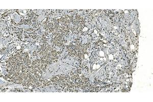 IHC analysis of LSM8 using anti-LSM8 antibody (ABIN7599579). (NAA38 anticorps  (AA 1-96))