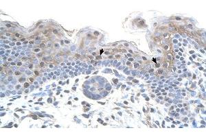 STRAP antibody was used for immunohistochemistry at a concentration of 4-8 ug/ml to stain Squamous epithelial cells (arrows) in Human Skin.