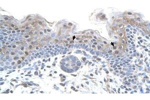STRAP antibody was used for immunohistochemistry at a concentration of 4-8 ug/ml to stain Squamous epithelial cells (arrows) in Human Skin.