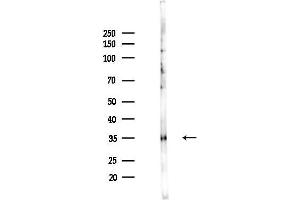 Western blot analysis of lysates from PC12 cells(UV,30 min treatment), using HLA Class I Antibody at 1/1000 dilution.