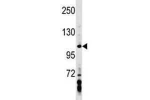 AXIN1 antibody western blot analysis in MDA-MB453 lysate.