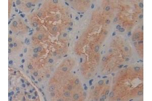 Detection of ENPEP in Human Kidney Tissue using Polyclonal Antibody to Aminopeptidase A (ENPEP)