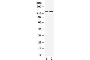 Western blot testing of human 1) SMMC and 2) 293 cell lysate with TRPM5 antibody. (TRPM5 anticorps  (AA 1021-1108))