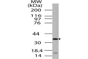 Image no. 1 for anti-G protein beta subunit-like (GBL) (AA 100-320) antibody (ABIN5027338) (GBL anticorps  (AA 100-320))
