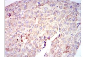 Image no. 2 for anti-V-Raf-1 Murine Leukemia Viral Oncogene Homolog 1 (RAF1) antibody (ABIN1500583) (RAF1 anticorps)