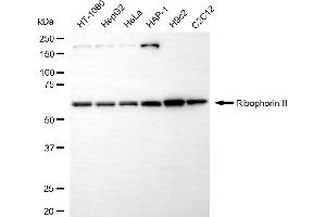 anti-Ribophorin II (RPN2) antibody