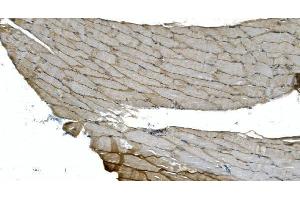 IHC analysis of H Cadherin/CDH13 using anti-H Cadherin/CDH13 antibody (ABIN7600095).