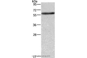 Western blot analysis of A172 cell, using AMIGO2 Polyclonal Antibody at dilution of 1:597 (AMIGO2 anticorps)