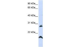 SPATA9 antibody used at 1 ug/ml to detect target protein.
