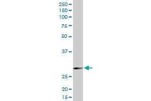 SNAP29 MaxPab rabbit polyclonal antibody. (SNAP29 anticorps  (AA 1-258))
