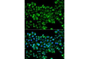 Immunofluorescence analysis of A549 cells using CBR3 antibody (ABIN5975603). (CBR3 anticorps)