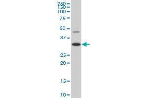 HOXD8 monoclonal antibody (M02), clone 3G8 Western Blot analysis of HOXD8 expression in HepG2 . (HOXD8 anticorps  (AA 126-190))