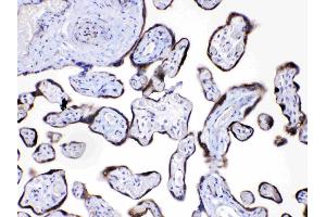 Angiopoietin-2 was detected in paraffin-embedded sections of human placenta tissues using rabbit anti- Angiopoietin-2 Antigen Affinity purified polyclonal antibody (Catalog # ) at 1 µg/mL.