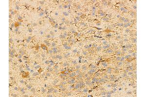 ABIN6256878 and ABIN6274572 at 1/100 staining Mouse brain tissue by IHC-P. (Serotonin Receptor 2B anticorps  (Internal Region))