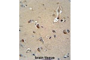 Immunohistochemistry (IHC) image for anti-Myelin Protein Zero (MPZ) antibody (ABIN3003838)