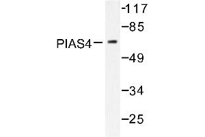 Image no. 2 for anti-Protein Inhibitor of Activated STAT, 4 (PIAS4) antibody (ABIN271954) (PIAS4 anticorps)