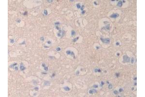 Used in DAB staining on fromalin fixed paraffin- embedded liver tissue