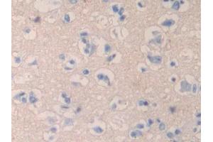 Used in DAB staining on fromalin fixed paraffin- embedded liver tissue (QSOX1 anticorps  (AA 37-181))