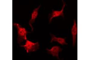 ABIN6269087 staining HeLa by IF/ICC. (HSP27 anticorps  (Internal Region))