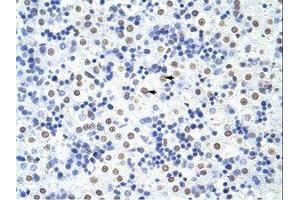 Image no. 1 for anti-Heterogeneous Nuclear Ribonucleoprotein U-Like 1 (HNRNPUL1) (C-Term) antibody (ABIN203251)