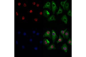 ABIN7093889 and ABIN7097932 staining Hela cells by IF/ICC.