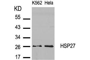 Image no. 2 for anti-Heat Shock 27kDa Protein 1 (HSPB1) (AA 80-84) antibody (ABIN197490) (HSP27 anticorps  (AA 80-84))