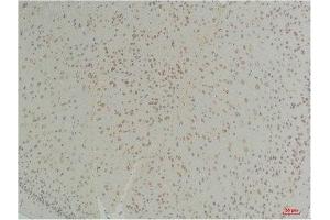 Immunohistochemistry (IHC) analysis of paraffin-embedded Mouse Brain Tissue using Connexin-26Rabbit Polyclonal Antibody diluted at 1:200. (GJB2 anticorps)