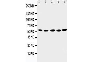 Anti-ABI2 antibody, Western blotting Lane 1: Rat Brain Tissue Lysate Lane 2: Human Placenta Tissue Lysate Lane 3: MCF-7 Cell Lysate Lane 4: HELA Cell Lysate Lane 5: JURKAT Cell Lysate (ABI2 anticorps  (N-Term))