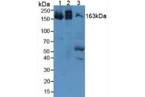 Rabbit Capture antibody from the kit in WB with Positive Control: Sample Mouse heart tissue.