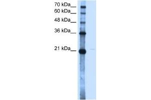 OLR1 antibody used at 2. (OLR1 anticorps)