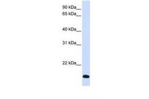 Image no. 1 for anti-Ring Finger Protein 185 (RNF185) (AA 74-123) antibody (ABIN6738076) (RNF185 anticorps  (AA 74-123))