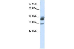 WB Suggested Anti-SIRT5 Antibody Titration:  5. (SIRT5 anticorps  (C-Term))