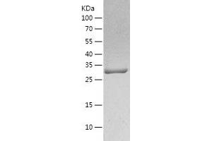 Western Blotting (WB) image for Carbonic Anhydrase I (CA1) (AA 1-261) protein (His tag) (ABIN7122126)