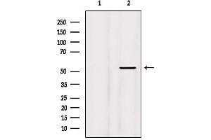 Western blot analysis of extracts from Mouse brain, using Phospho-MEF2A (Thr319) Antibody. (MEF2A anticorps  (pThr319))