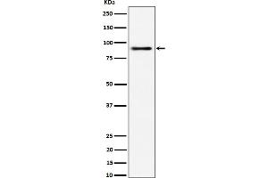 Western blot analysis of ACAP2 expression in 293 cell lysate.